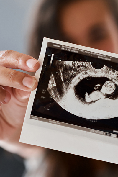 Echographie : votre bébé sous toutes ses coutures